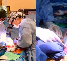 Medicina : Médicos realizan trasplante de dos riñones de cerdo a humano